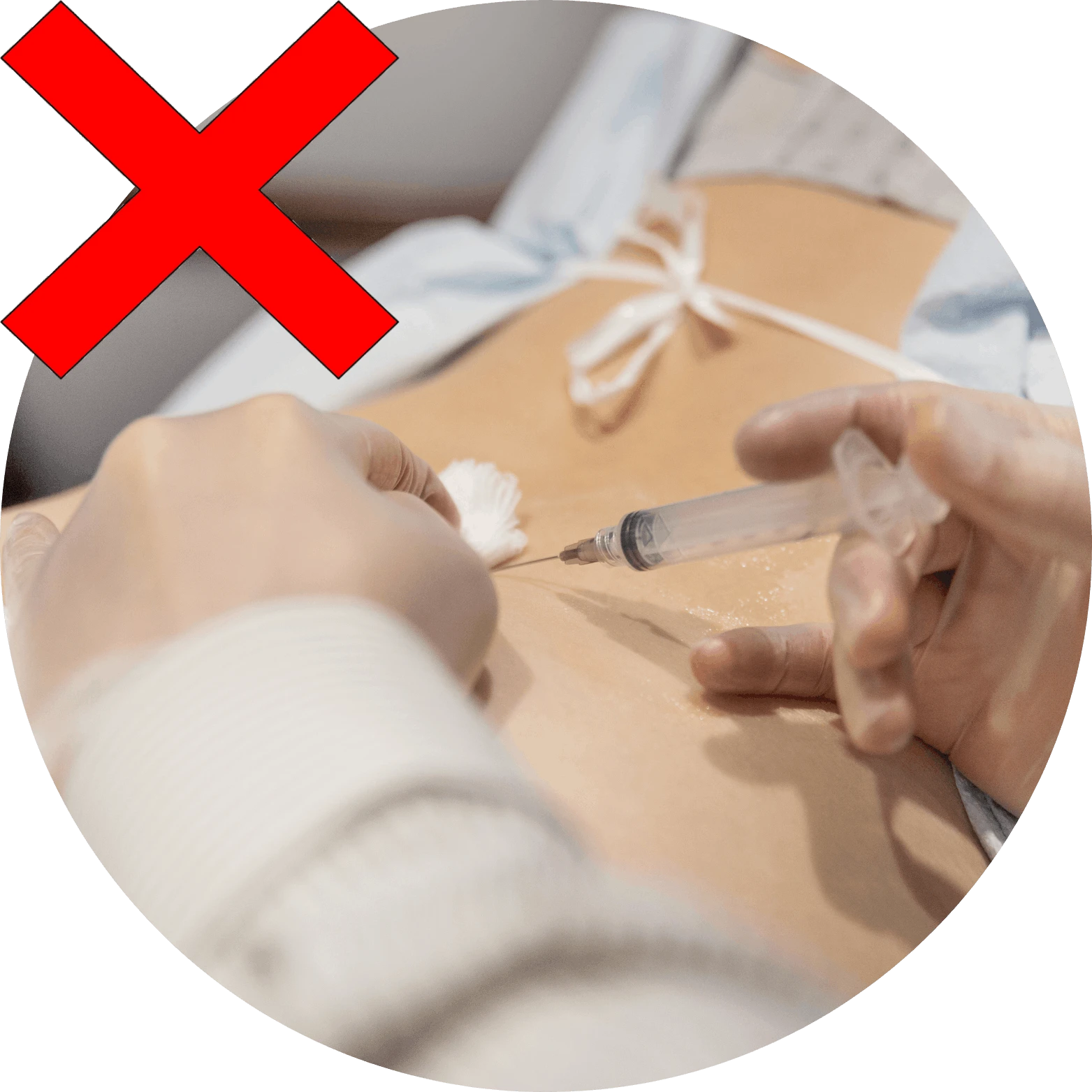 Injections de cortisone