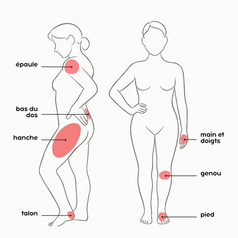 Le trouble le plus mal diagnostiqué après 50 ans ?le syndrome musculo-squelettique de la ménopause.